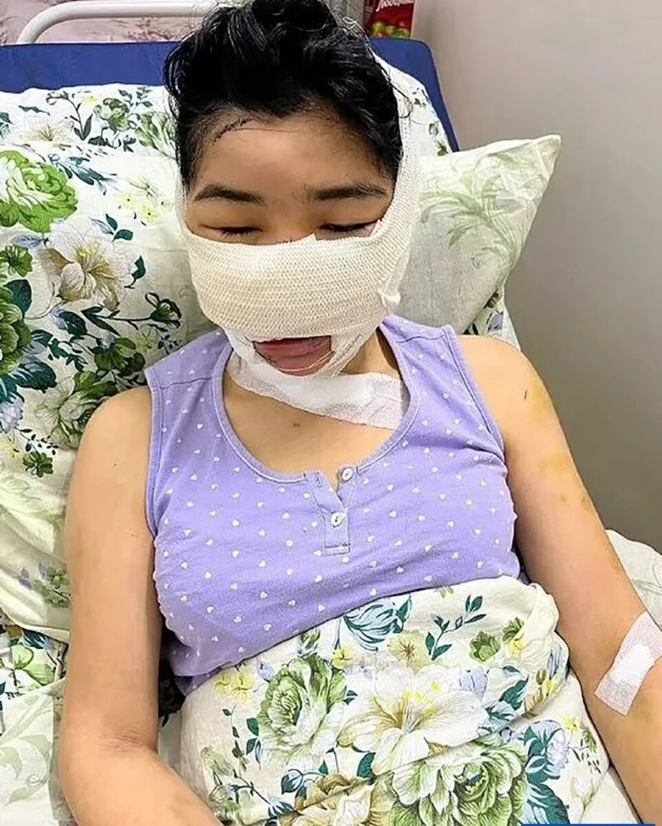 Асель в больнице. Фото: dailymail.co.uk