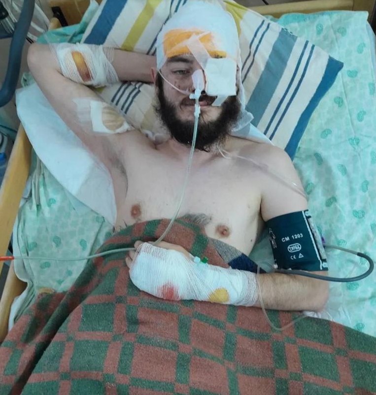 Йонас Краценберг после ранения на войне на Украине © fkn