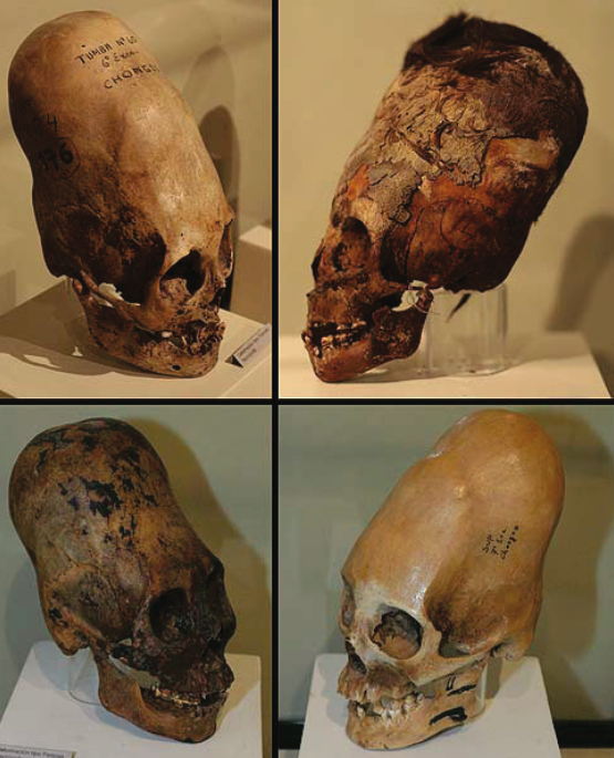 Черепа удлиненной формы в Региональном музее Ики. Изображение взято из книги А. Ю. Склярова «Перу и Боливия задолго до инков», издательство ВЕЧЕ, 2011