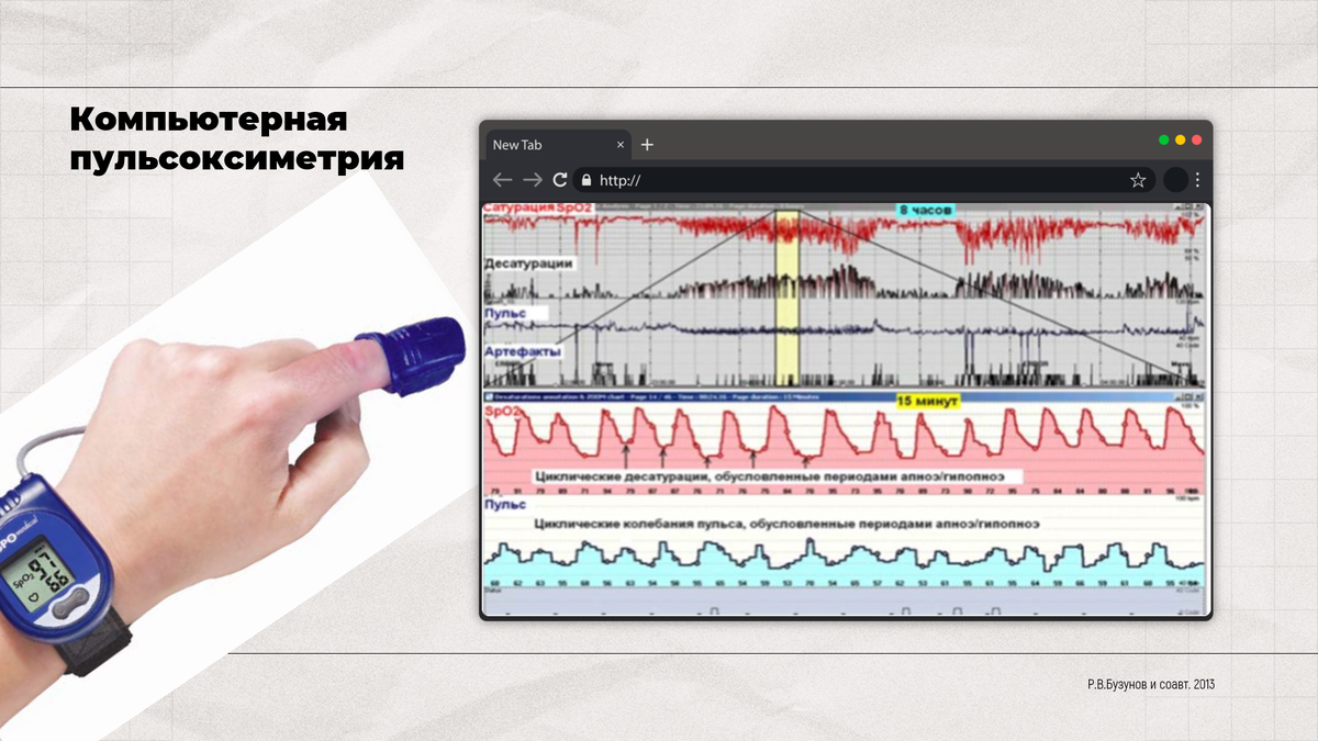 Самое простое, что можно сделать - это выполнить ночную пульсоксиметрию. Но это не тот пульсоксиметр, который мы однократно надеваем на палец. Это именно ночной мониторинг сатурации. Для постановки диагноза не годится, только для скрининга, чтобы отсеять тех, кого углубленно обследовать дальше не надо. 
