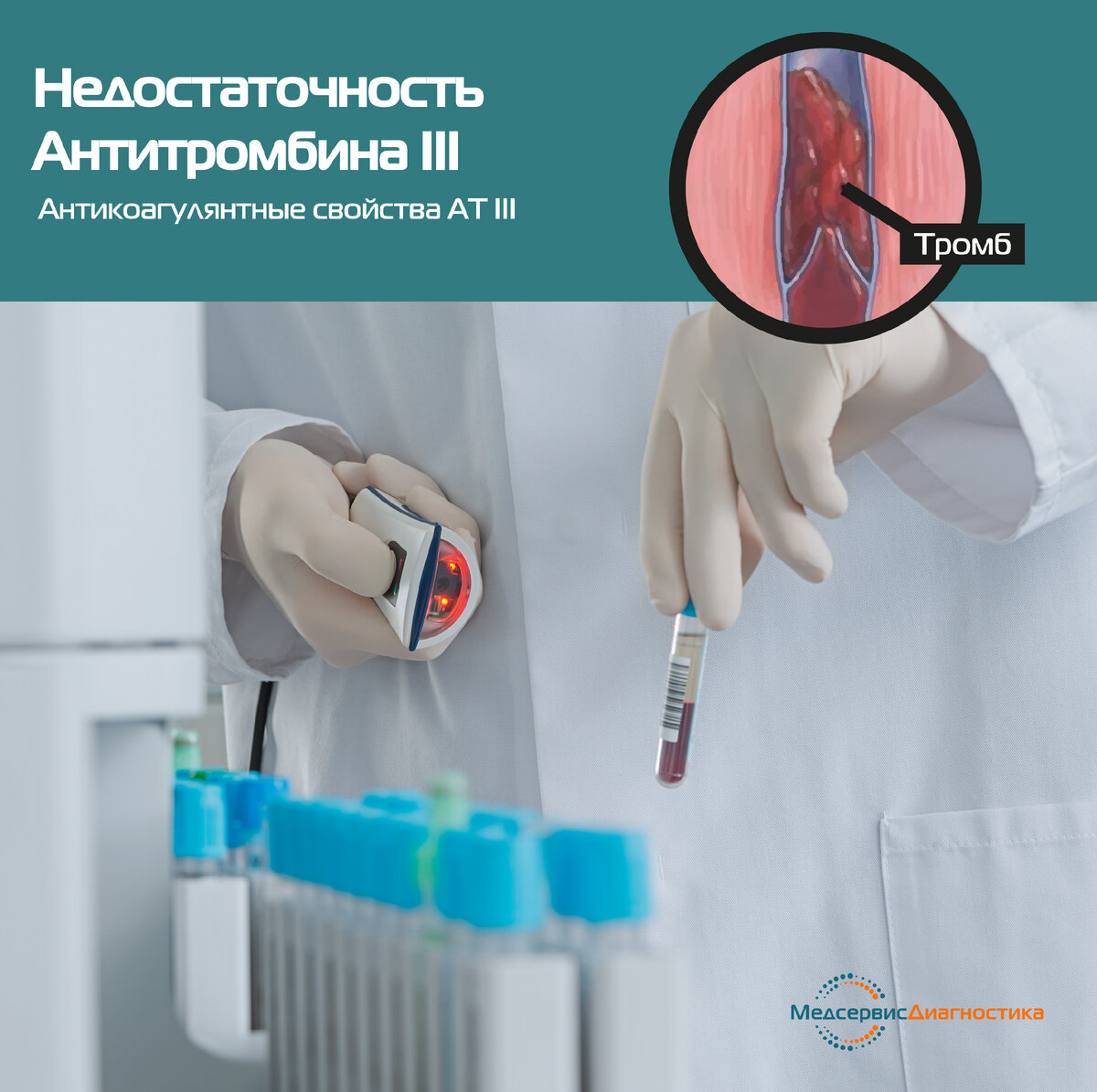 Антитромбин Antithrombin III реагенты Siemens
