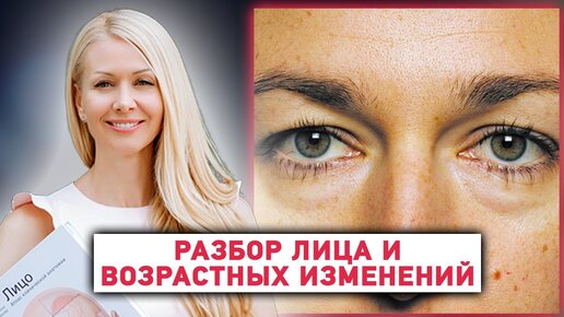 Папилломы, почему возникают, фото, когда необходимо удалять?