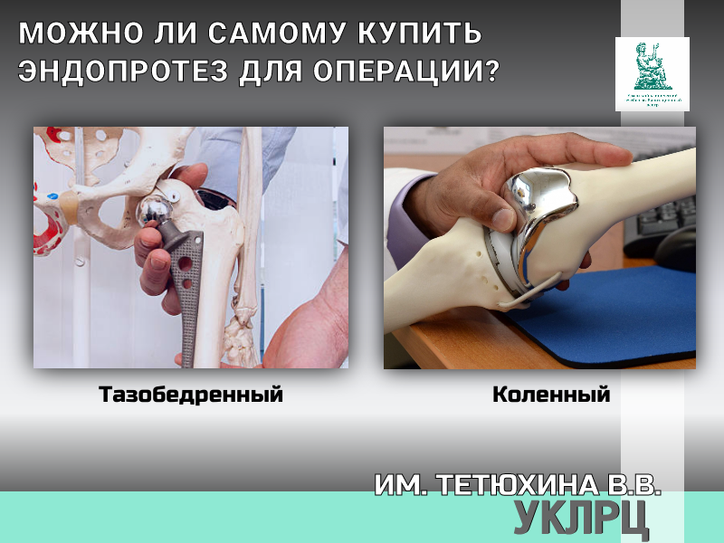 Может ли пациент самостоятельно купить эндопротез для замены сустава?