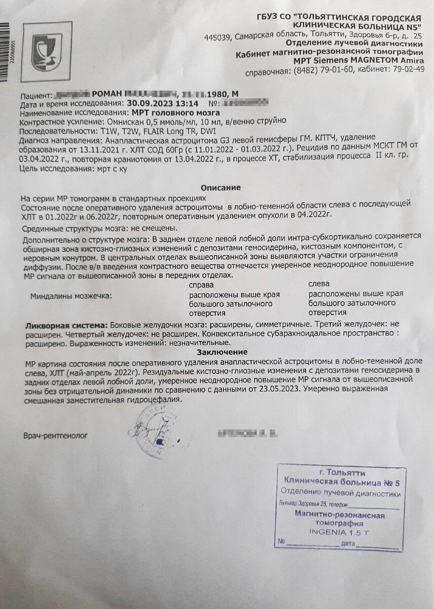 Рак мозга. Афазия. Результат МРТ головного мозга спустя 1,5 года после  второй трепанации. | Фаршики | Дзен