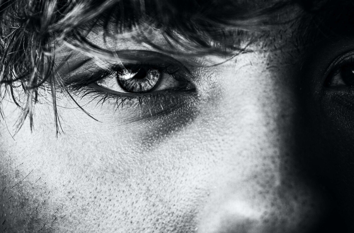 Расширенные поры чаще всего появляются в Т-зоне