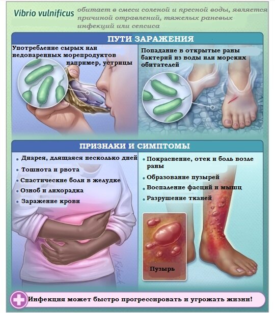 Переведено для Вас с английского. Источник: JAMA Network