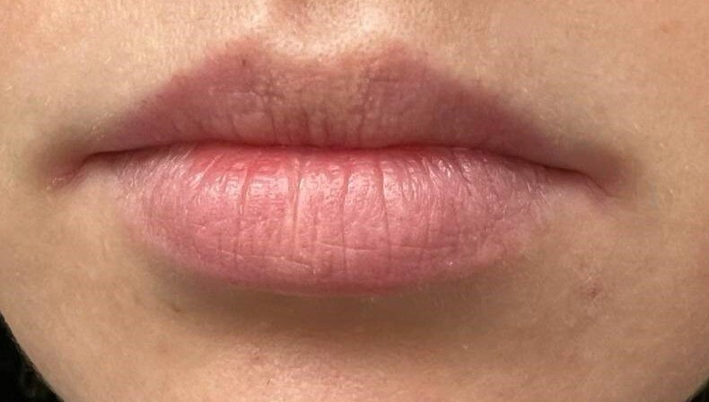 До/после использования уходовых средств бренда Serenity.Yard.