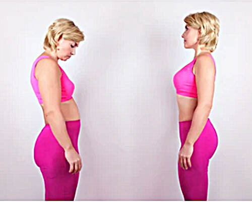 Сутулая фигура