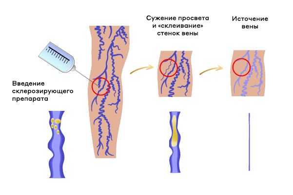 На базе ФСК КЛИНИК заработал центр флебологии и сосудистой хирургии