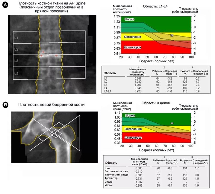 Скриншот Яндекс картинки