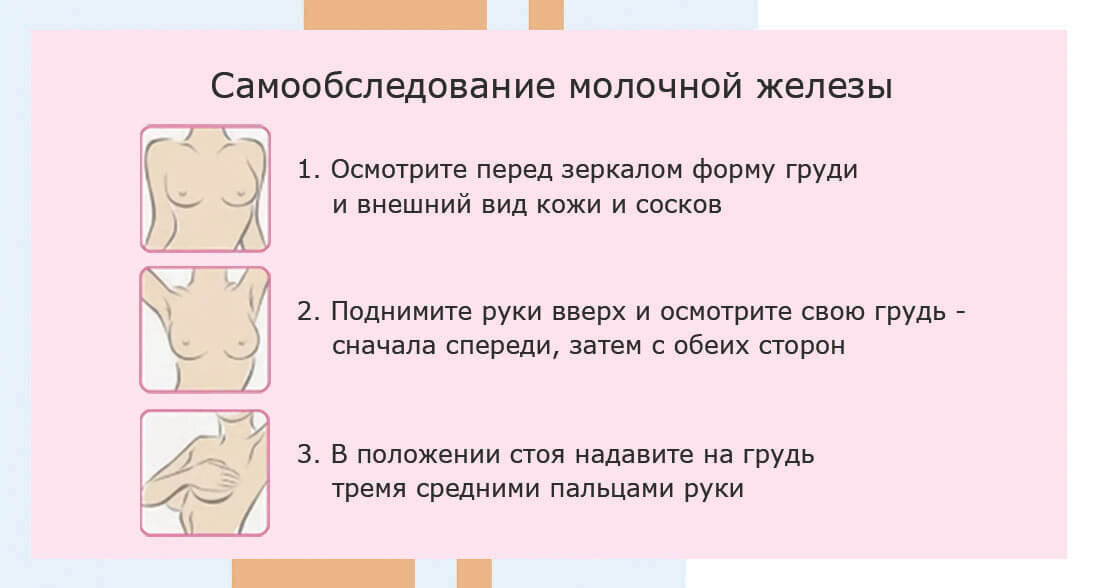 «Можно ли при кисте яичника?»: часто задаваемые вопросы пациенток с кистой