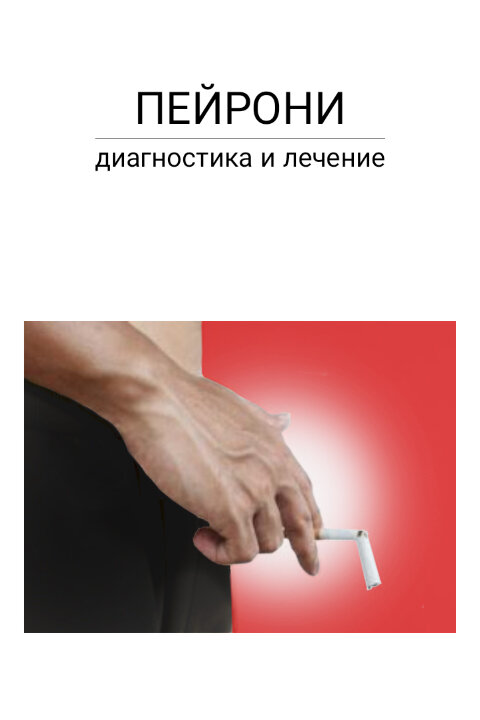 Уротрин реальные отзывы Сайт отзывов покупателей