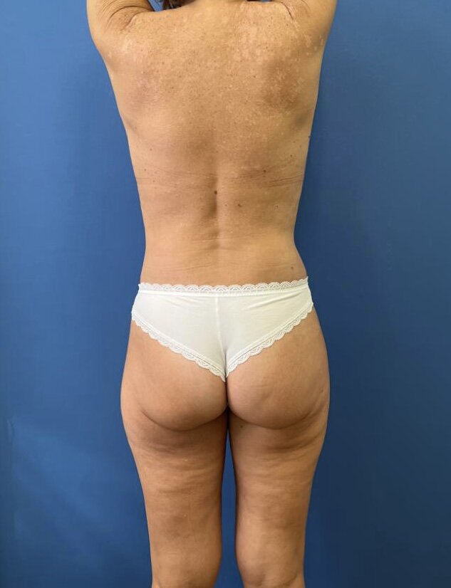 На фото пациентка Данилы Лупина. Имеются противопоказания, необходима консультация специалиста.