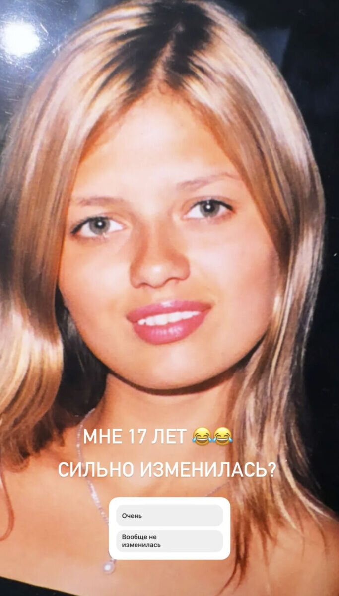 Боня до и после пластики Виктория Боня показала, как она выглядела в 17 лет New-magazine.ru Дзен