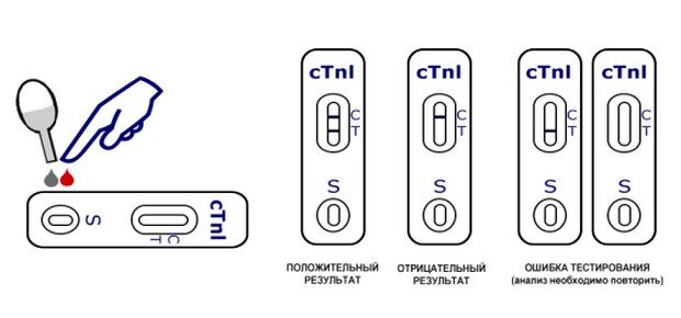 Исследование иммунного статуса (иммунограмма)