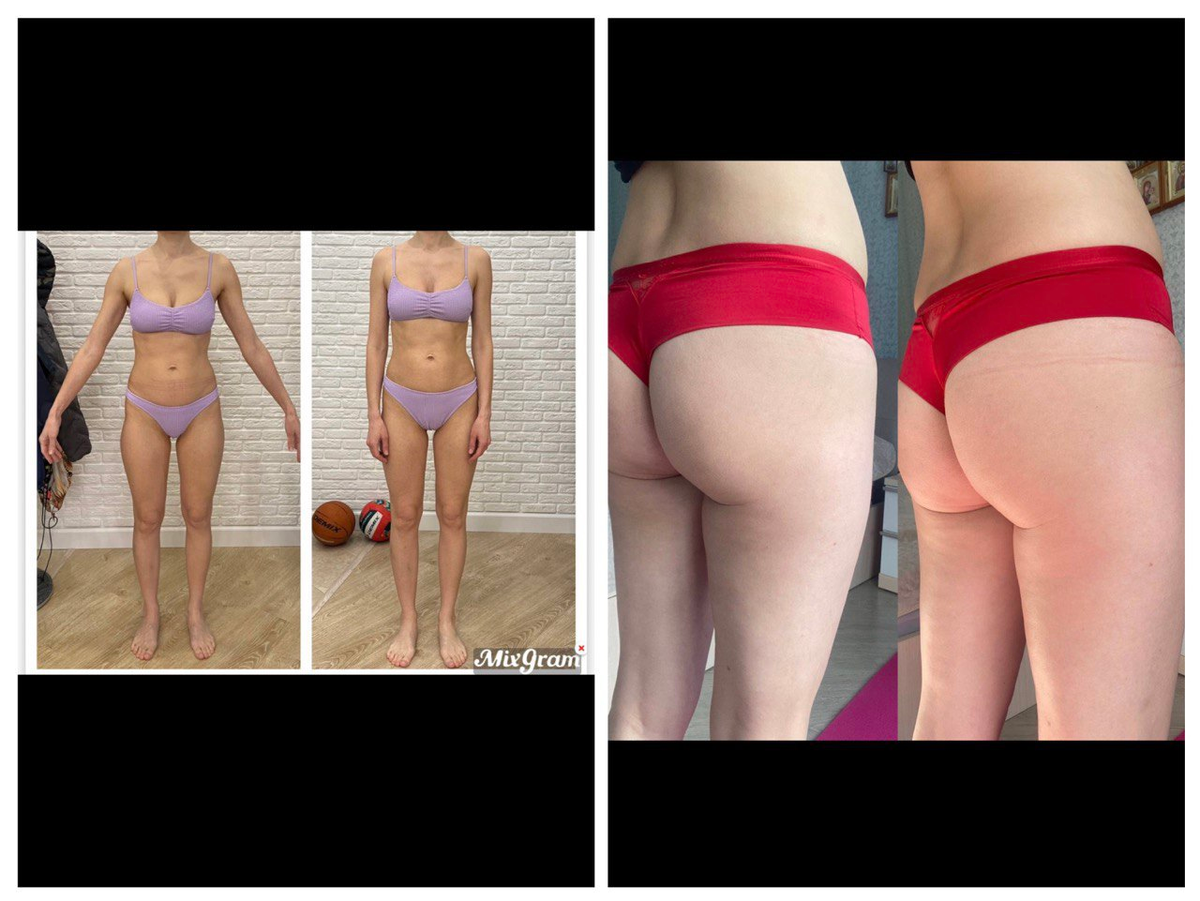 Результаты через 3 дня.