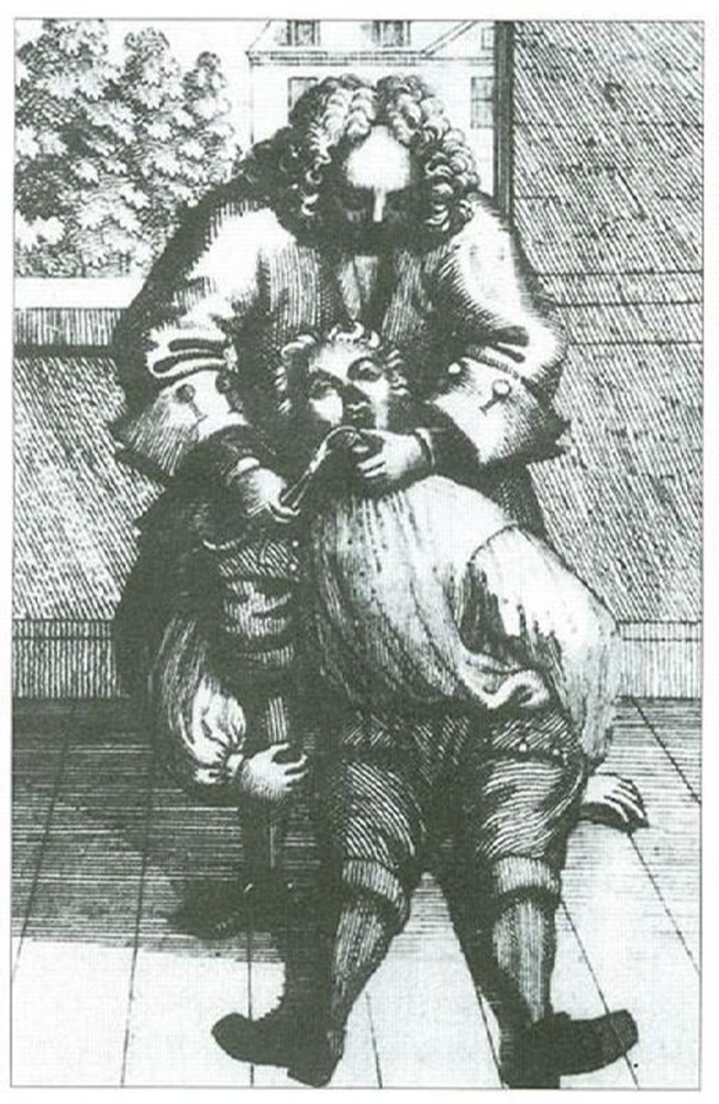 Неизвестный художник. Людвиг Крон с пациентом: в 1717 г. хирург Людвиг Крон демонстрирует самую удобную (как считалось в то время) позу для удаления зубов нижней челюсти. Источник изображения: wanderlord.com