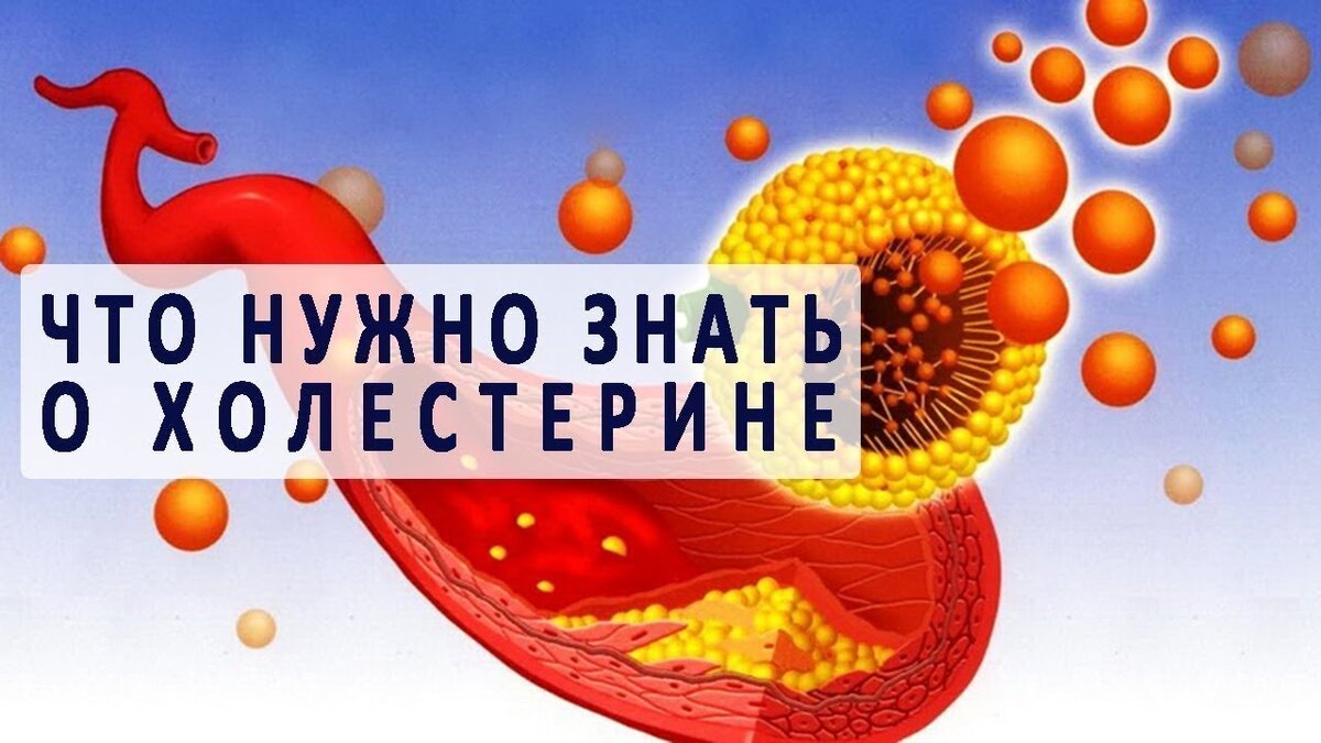 Сегодня начнем цикл статей о холестеринофобии... Фото заимствовано на просторах интернета)