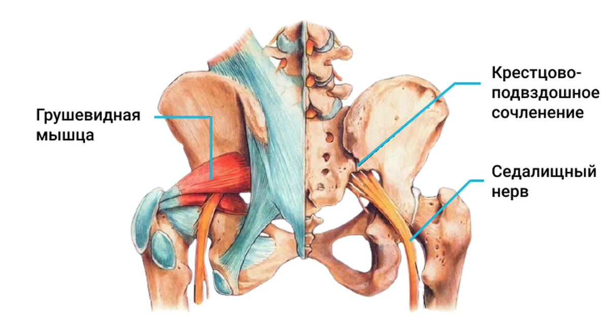 Грушевидная Piriformis