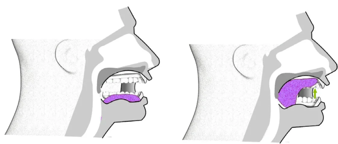 как должен лежать язык во рту