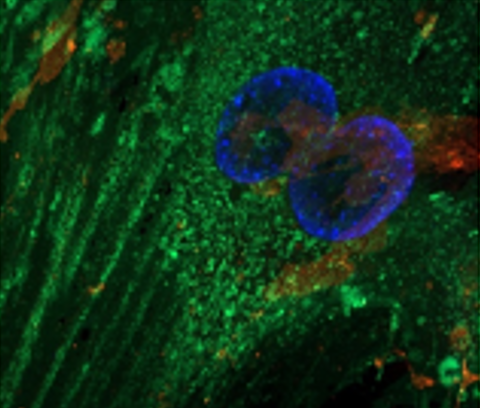 Клетки с высоким уровнем белка р16 (окрашены в зеленый цвет). Источник: Олег Демидов