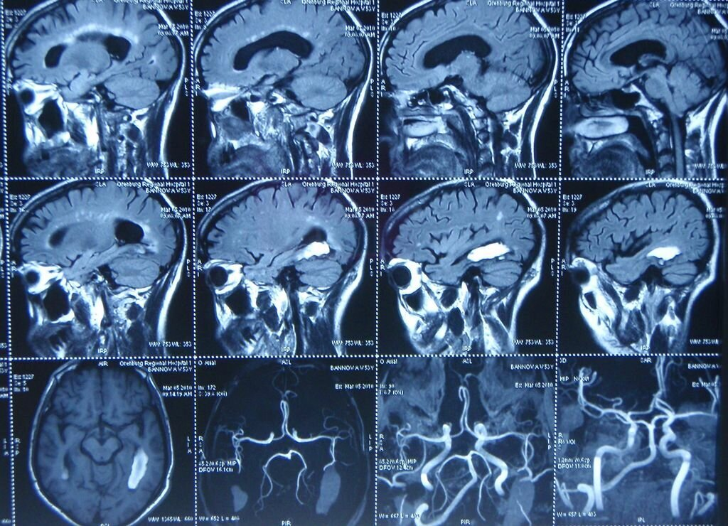 Магнитно резонансные томограммы головного мозга. Кт томограмма головного мозга. Кт (компьютерная томография) сосудов головного мозга. Магнитно-резонансная томография (мрт) сосудов головного мозга. Мрт головы