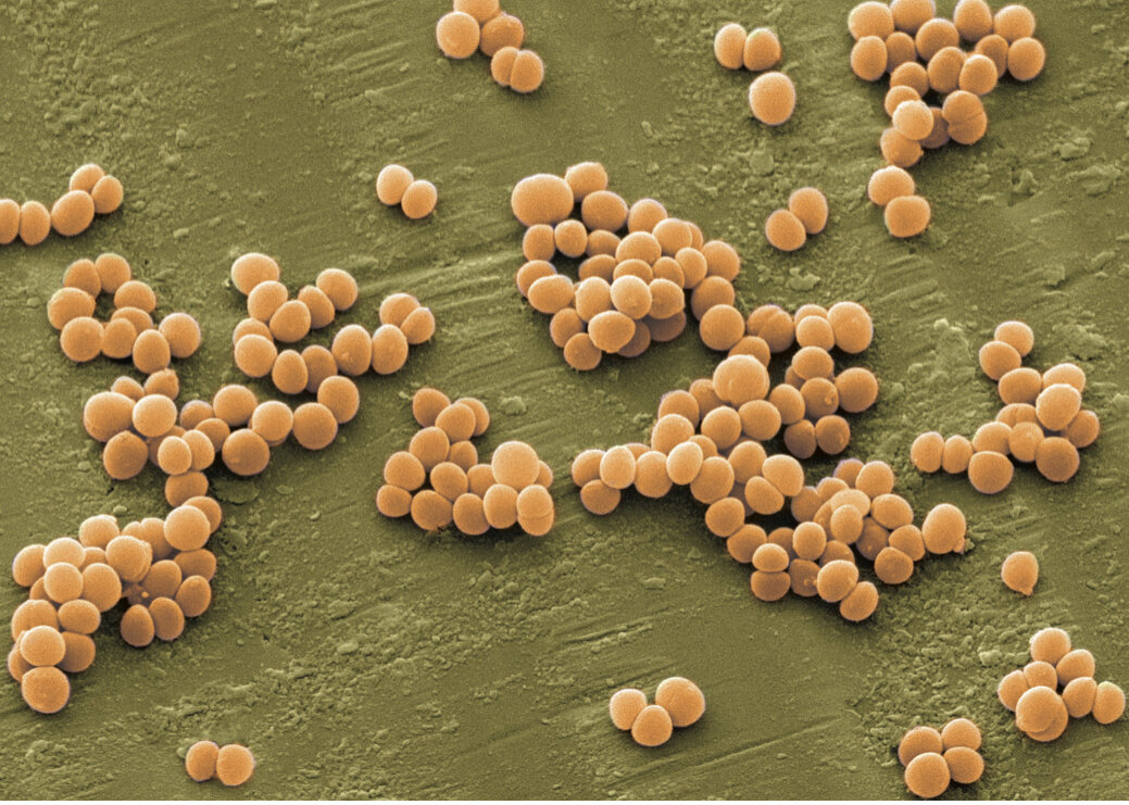 Фото с сайта yachist.ru