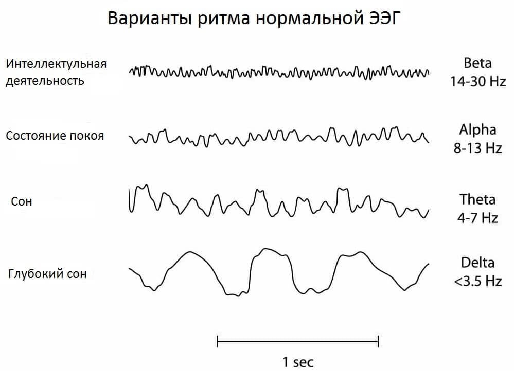 Альфа активность Альфа активность