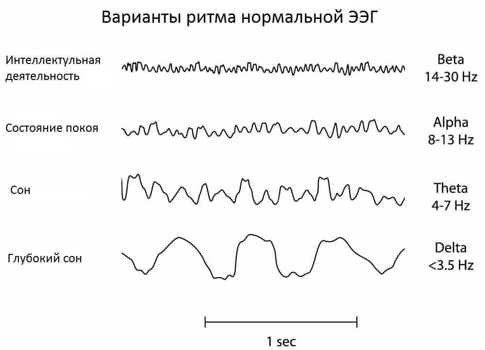 Альфа активность