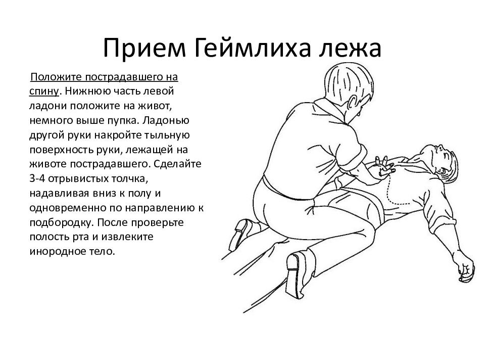 Человек подавился. Что делать? Источник: http://www.obzh.ru/articles/bazovye-nav