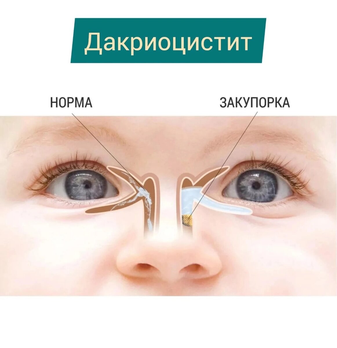 Яндекс.картинки 