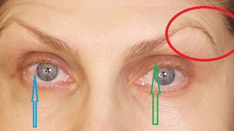 Косметологическая ошибка которая мешает женщинам бороться с морщинами