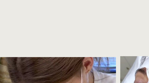 Медицинский центр ВиАнта | Почему комплексная чистка лица включена в ...