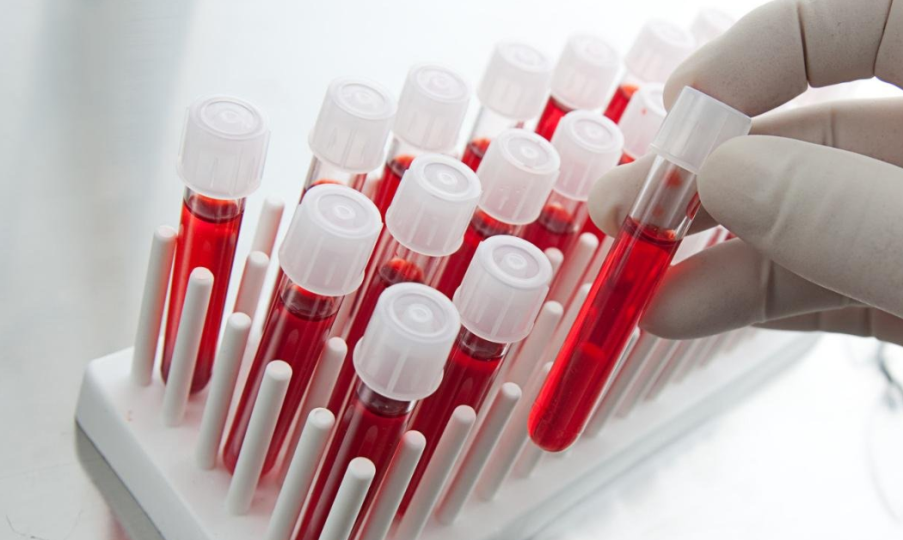 Биохимический анализ крови — что покажет и для чего нужен этот анализ