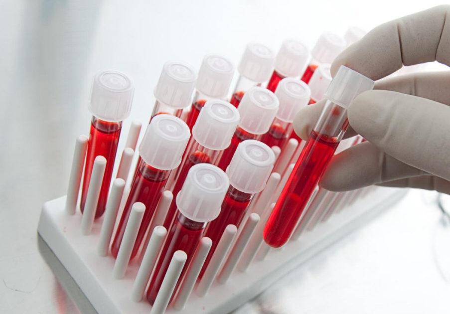 Биохимический анализ крови — один из самых часто назначаемых анализов.