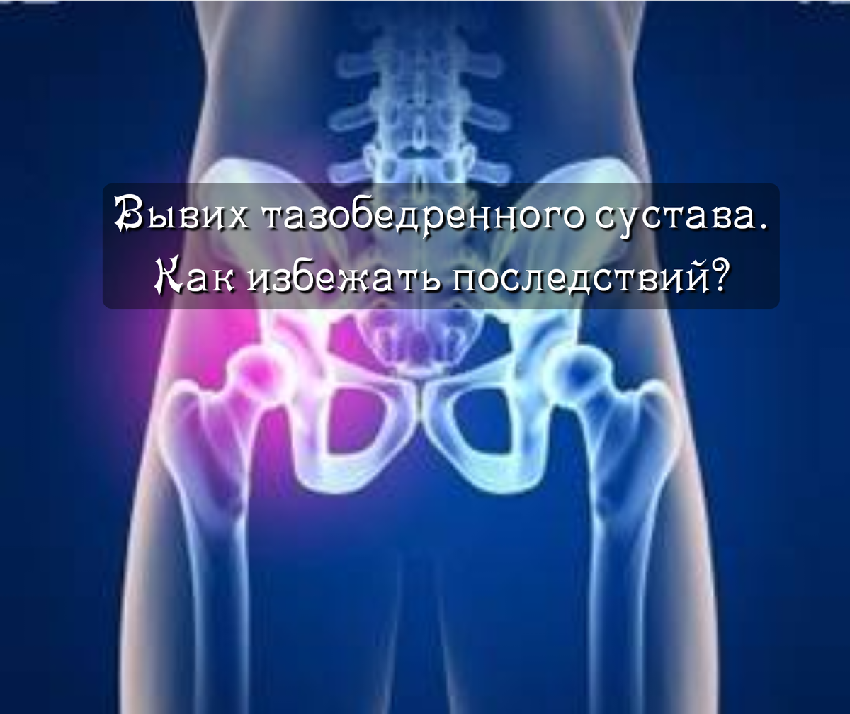 Как лечить подвывих голеностопа. Растяжение связок голеностопа: лечение и последствия Серьёзная проблема, требующая незамедлительной терапии — вывих. Вывих голеностопа: виды, симптоматика и терапия