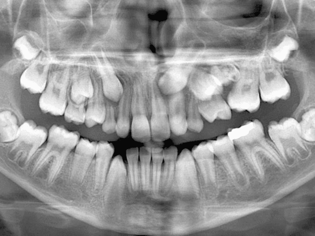 Большие зубы: понимаем причины, корректируем форму и исследуем особенности передних зубов