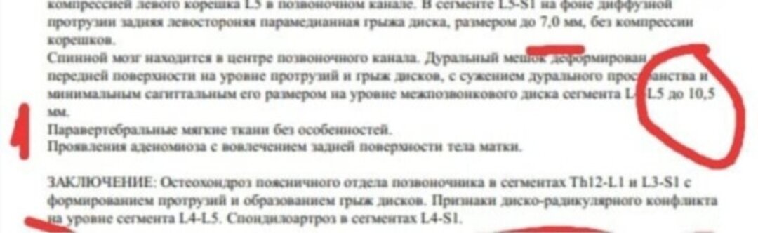 Пример заключения невролога по МРТ из практики