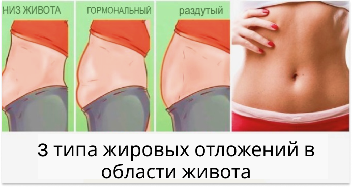 Почему у женщин жир откладывается на животе. Висцеральный жир картинки для презентации. висцеральный жир как от него избавиться женщине.