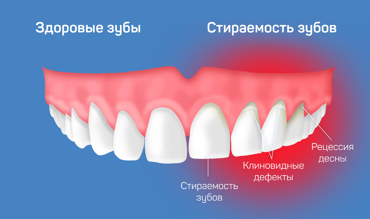 RDA в маркировке зубных паст: почему не везде указывается индекс  абразивности | ДокторСлон | Эксперт в уходе за полостью рта | Дзен