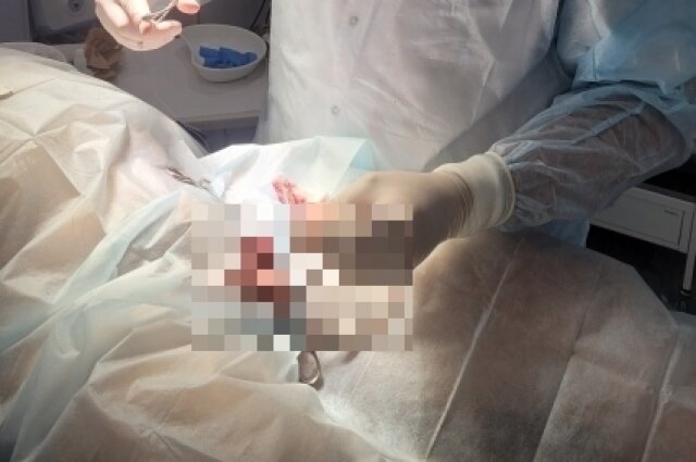    К счастью, восстановиться после такой неприятности можно полностью. Фото: Из личного архива/ Сергей Гапонюк