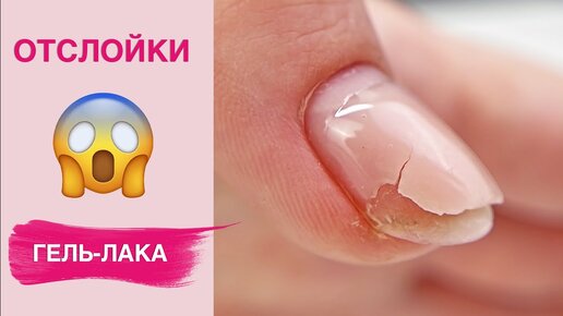 Причины отслойки гель-лака | Секреты носки маникюра