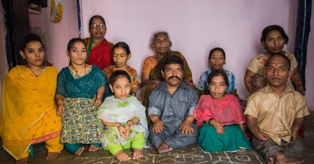 Индийское общество было. Две семьи в Индии. Семьи с ахондроплазия.