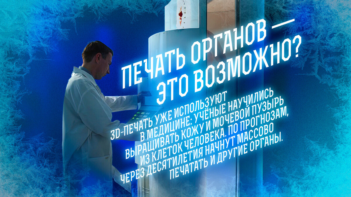 -7