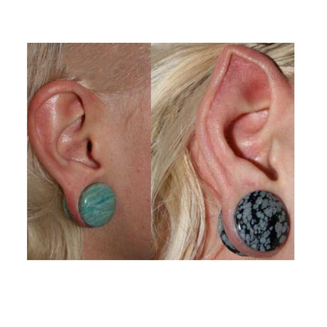 Так выглядят «эльфийские уши»