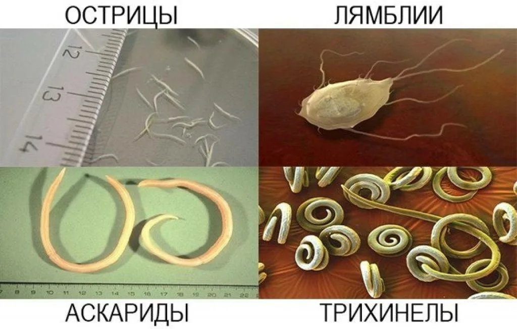 Как выглядят глисты у рака Аскариды и острицы - CollectPhoto.ru