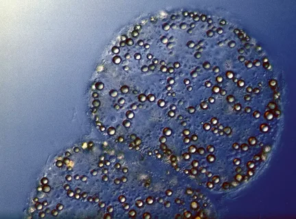 Серобактерии.