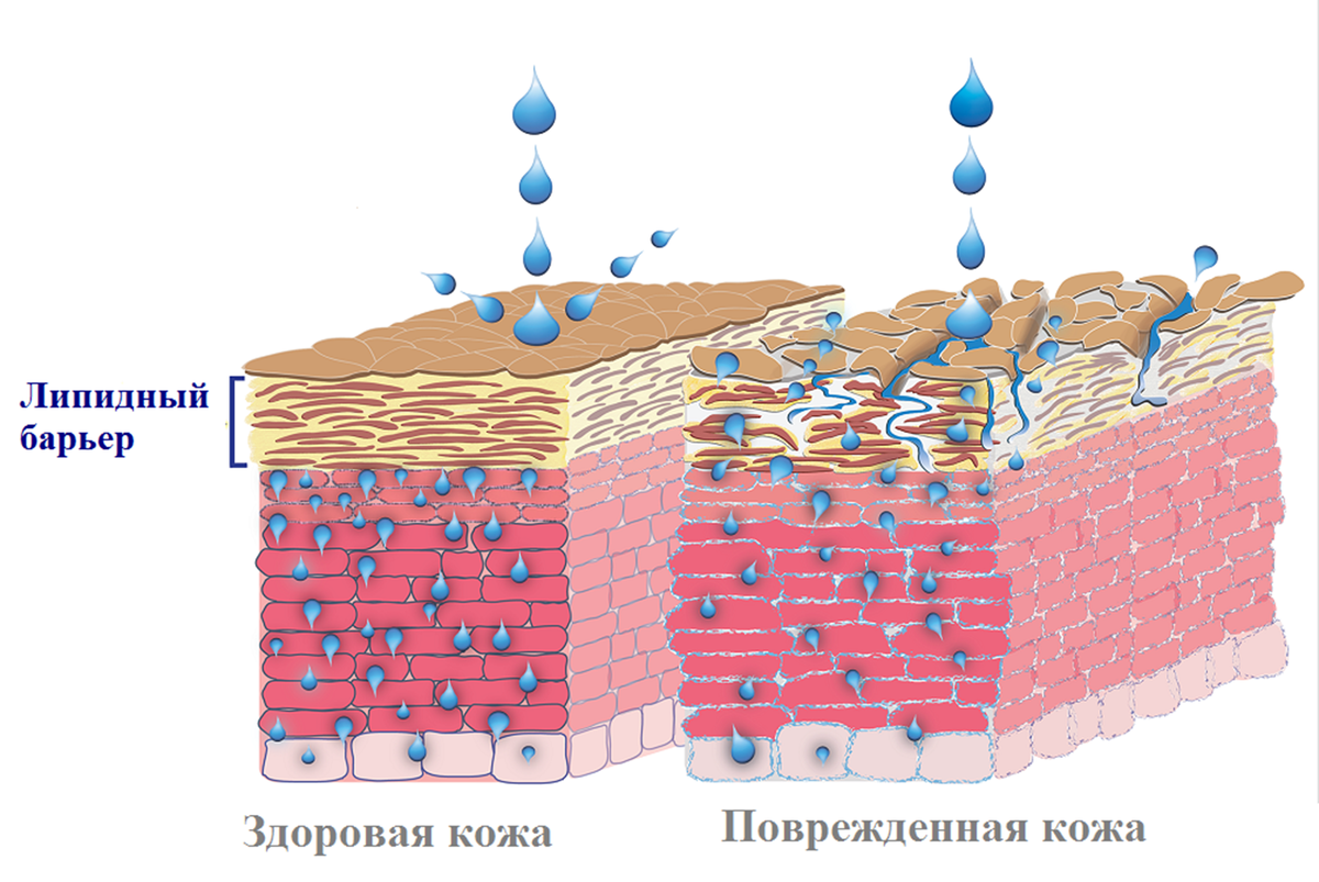 Гидрофильная кожа. Эпидермальный липидный барьер. Гидролипидная мантия и эпидермальный барьер. Эпидермальный барьер гидролипидная мантия и кожи это. Строение эпидермиса гидролипидная мантия.