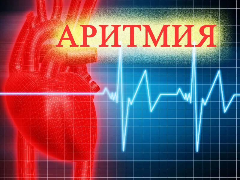 Аритмия сердца симптомы лечение. Аритмия. Аритмия сердца. Арифмея. Римия