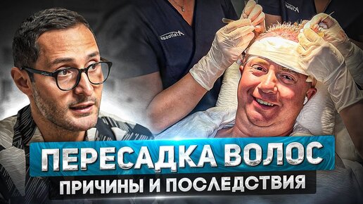 Все о пересадке волос у мужчин. Что делать, если появились залысины?